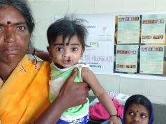 Baby with cleft lip