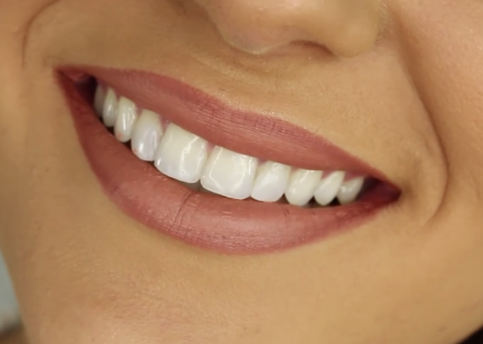 oral health in India