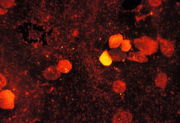 Tuberculosis Bacteria