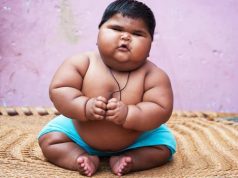 child obesity