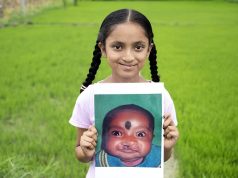 Smile Train and Sirat unite to transform smiles and empower India's cleft community