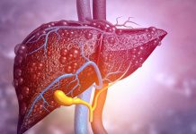 Fatty Liver