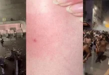 France Paris Music Fest Syringe Attack