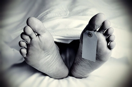 Dead Body
