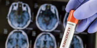 AI Blood Test for Alzheimer's