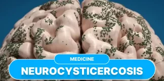 Neurocysticercosis