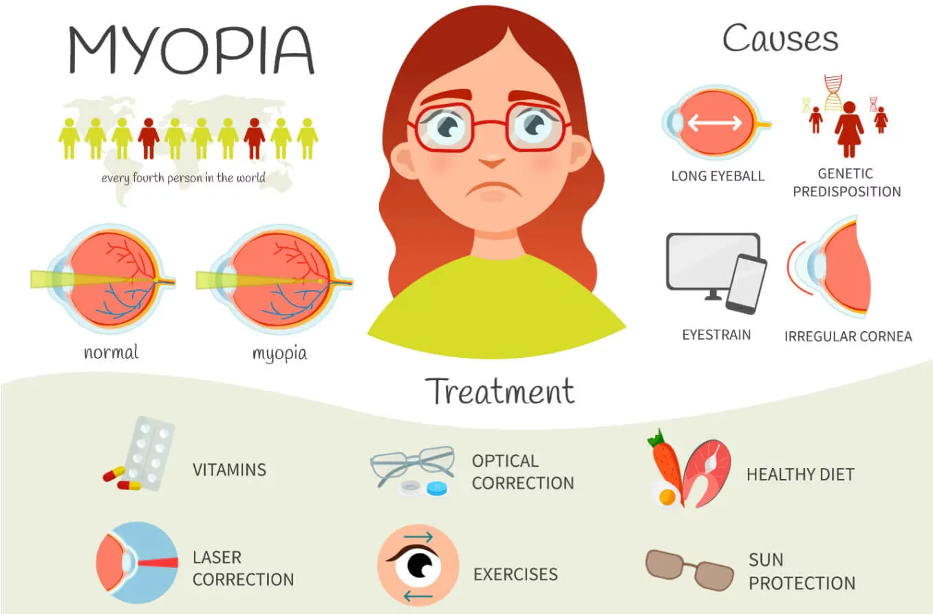 Myopia is rapidly rising globally, with lifestyle factors like low-light indoor activities contributing to the condition